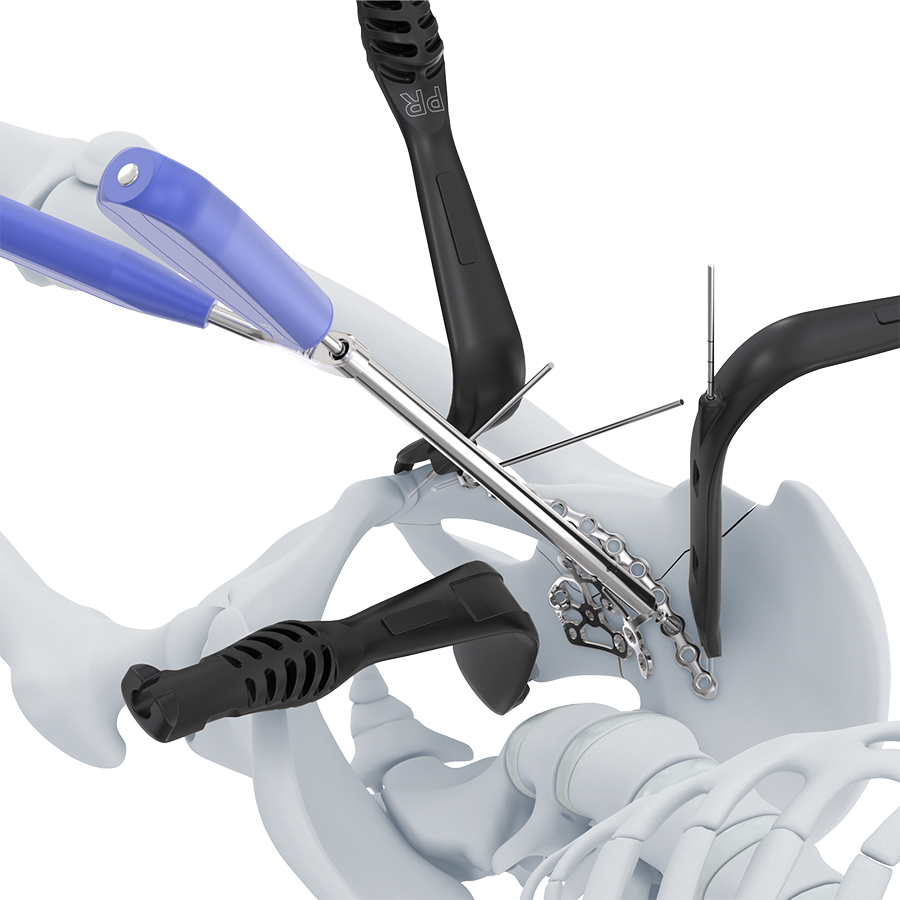 Pelvic & Acetabular Instruments