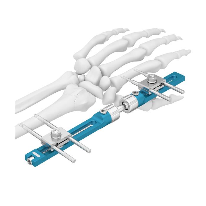 Wrist Fixator