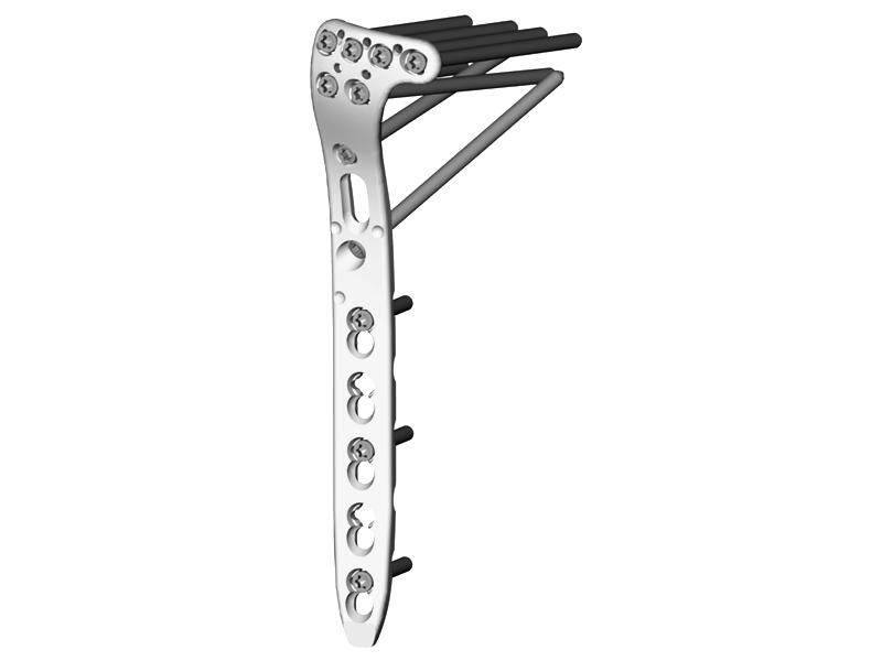 Tibial Preparation Instruments